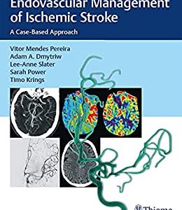 Endovascular Management of Ischemic Stroke: A Case-Based Approach (EPUB)