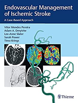 Endovascular Management of Ischemic Stroke: A Case-Based Approach (EPUB)