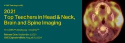 2021 Top Teachers in Head and Neck, Brain and Spine Imaging (Videos)