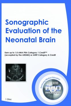 AIUM Sonographic Evaluation of the Neonatal Brain (Videos)