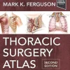 Thoracic Surgery Atlas, 2nd Edition (True PDF from Publisher)
