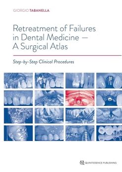 Retreatment of Failures in Dental Medicine: A Surgical Atlas: Step-by-Step Clinical Procedures (Scanned PDF)