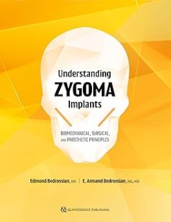 Understanding Zygoma Implants: Biomechanical, Surgical, and Prosthetic Principles (Original PDF from Publisher)