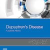 Dupuytren’s Disease: A Scientific Review (Original PDF from Publisher)