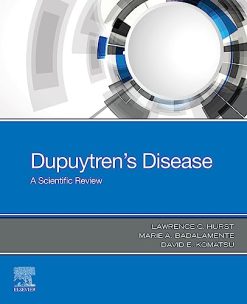 Dupuytren’s Disease: A Scientific Review (Original PDF from Publisher)