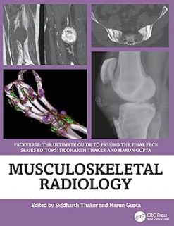 Musculoskeletal Radiology: An Ultimate Guide to Passing the Final FRCR (FRCRverse) (Original PDF from Publisher)