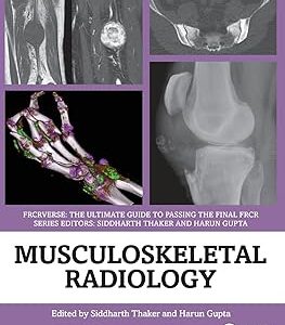 Musculoskeletal Radiology: An Ultimate Guide to Passing the Final FRCR (FRCRverse) (Original PDF from Publisher)