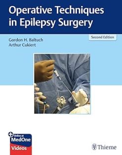 Operative Techniques in Epilepsy Surgery, 2nd edition (Original PDF from Publisher+Videos)