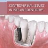 Controversial Issues in Implant Dentistry (Scanned PDF)