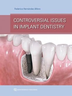 Controversial Issues in Implant Dentistry (Scanned PDF)