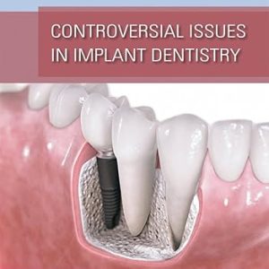 Controversial Issues in Implant Dentistry (Scanned PDF)