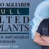 Full tilted implants: Prosthetic and Surgical protocols 2023 (Osteocom) (Videos)