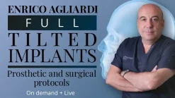 Full tilted implants: Prosthetic and Surgical protocols 2023 (Osteocom) (Videos)