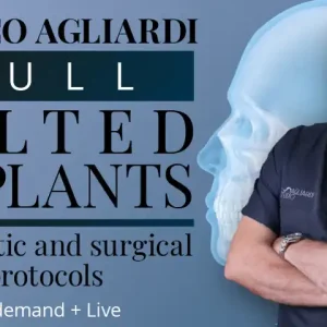 Full tilted implants: Prosthetic and Surgical protocols 2023 (Osteocom) (Videos)