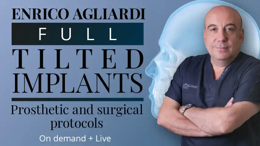 Full tilted implants: Prosthetic and Surgical protocols 2023 (Osteocom) (Videos)