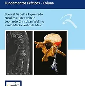 Condutas em Neurocirurgia: Fundamentos Práticos – Coluna (Portuguese Edition) (EPUB)