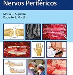 Lesões Traumáticas de Nervos Periféricos (Portuguese Edition) (EPUB)
