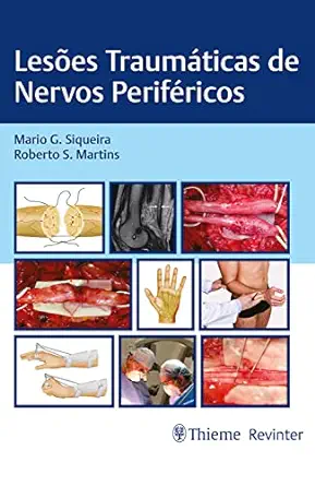 Lesões Traumáticas de Nervos Periféricos (Portuguese Edition) (EPUB)