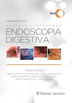 Tratado Ilustrado de Endoscopia Digestiva (Portuguese Edition) (EPUB)