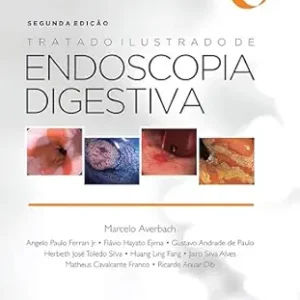 Tratado Ilustrado de Endoscopia Digestiva (Portuguese Edition) (EPUB)
