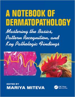 A Notebook of Dermatopathology: Mastering the Basics, Pattern recognition, and Key Pathologic Findings