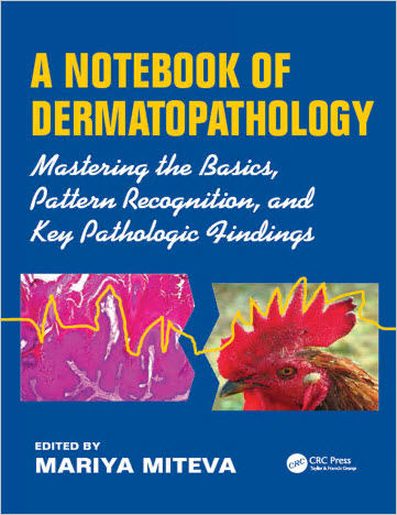 A Notebook of Dermatopathology: Mastering the Basics, Pattern recognition, and Key Pathologic Findings