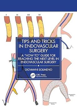 Tips and Tricks in Endovascular Surgery: A “How to” Guide for reaching the next Level in Endovascular Surgery (Original PDF from Publisher)