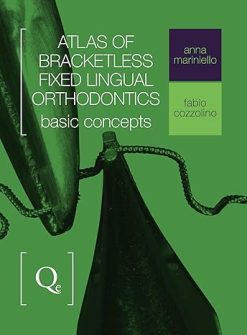 Atlas of Bracketless Fixed Lingual Orthodontics: Basic Concepts (Scanned PDF)