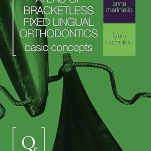 Atlas of Bracketless Fixed Lingual Orthodontics: Basic Concepts (Scanned PDF)