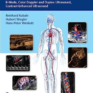 Vascular Ultrasound: B-Mode, Color Doppler and Duplex Ultrasound, Contrast-Enhanced Ultrasound (Original PDF from Publisher+Videos)