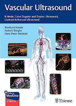 Vascular Ultrasound: B-Mode, Color Doppler and Duplex Ultrasound, Contrast-Enhanced Ultrasound (Original PDF from Publisher+Videos)
