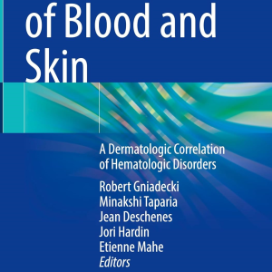 Diseases of Blood and Skin: A Dermatologic Correlation of Hematologic Disorders (EPUB)