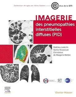Imagerie des pneumopathies interstitielles diffuses (PID) (French Edition) (Original PDF from Publisher)