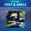 Ultrasound of the Foot and Ankle (EPUB/Video)