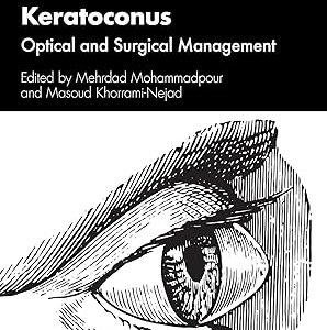 Keratoconus: Optical and Surgical Management (Original PDF from Publisher)