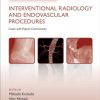 Challenging Concepts in Interventional Radiology