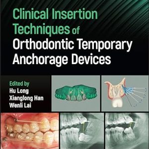Clinical Insertion Techniques of Orthodontic Temporary Anchorage Devices (Original PDF from Publisher)