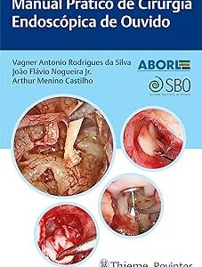 Manual Prático de Cirurgia Endoscópica de Ouvido (Portuguese Edition) (EPUB)