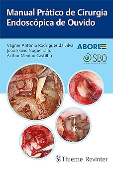 Manual Prático de Cirurgia Endoscópica de Ouvido (Portuguese Edition) (EPUB)