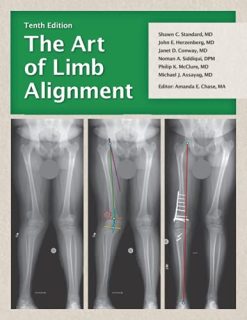 The Art of Limb Alignment, Tenth Edition (Original PDF from Publisher)