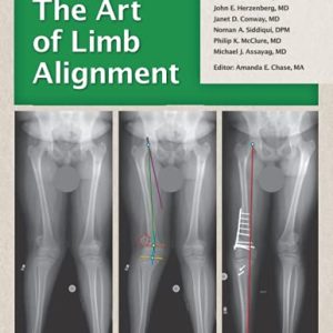 The Art of Limb Alignment, Tenth Edition (Original PDF from Publisher)