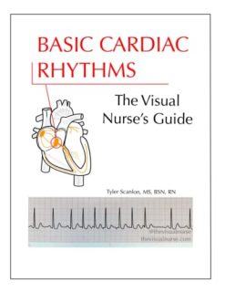 Basic Cardiac Rhythms: The Visual Nurse’s Guide (The Visual Nurse’s Basic ECG Series) (Azw3+epub+converted pdf)