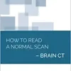 How to Read a Normal Scan : Brain CT (High Quality Image PDF)