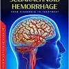 Aneurysmal Subarachnoid Hemorrhage: From Diagnosis to Treatment (Original PDF from Publisher)