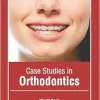 Case Studies in Orthodontics (Original PDF from Publisher)