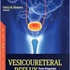 Vesicoureteral Reflux: From Diagnosis to Treatment (Original PDF from Publisher)