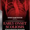 Early Onset Scoliosis: A Comprehensive Approach (Original PDF from Publisher)