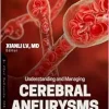 Understanding and Managing Cerebral Aneurysms (Original PDF from Publisher)
