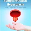 Benign Prostatic Hyperplasia: From Diagnosis to Treatment (Original PDF from Publisher)