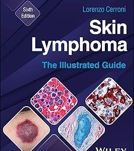Skin Lymphoma: The Illustrated Guide, 6th edition (Original PDF from Publisher)